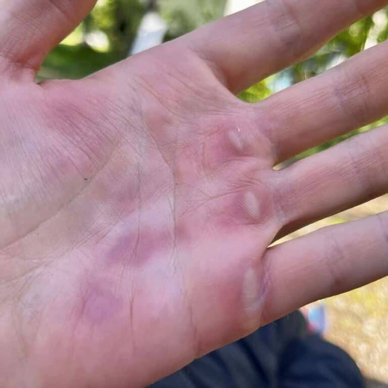 Eliminate Arm Pump & Avoid Hand Fatigue When Mountain Biking